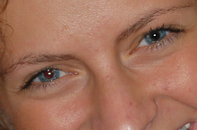 Redukcia červených očí